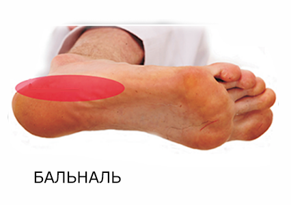 Бокова частина стопи, яка використовується для удару в Тхеквондо