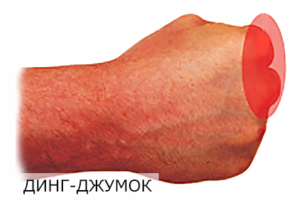 Тильна частина кулака яка використовується для удару в Тхеквондо