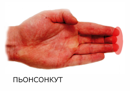 Кінчики випрямлених пальців в Тхеквондо